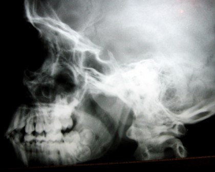 xray morguefile