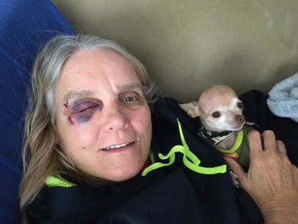 Lee Ann Smith, an animal control officer with the Haven Humane Society, is recovering.  Photo courtesy of Lee Ann Smith's Facebook page.